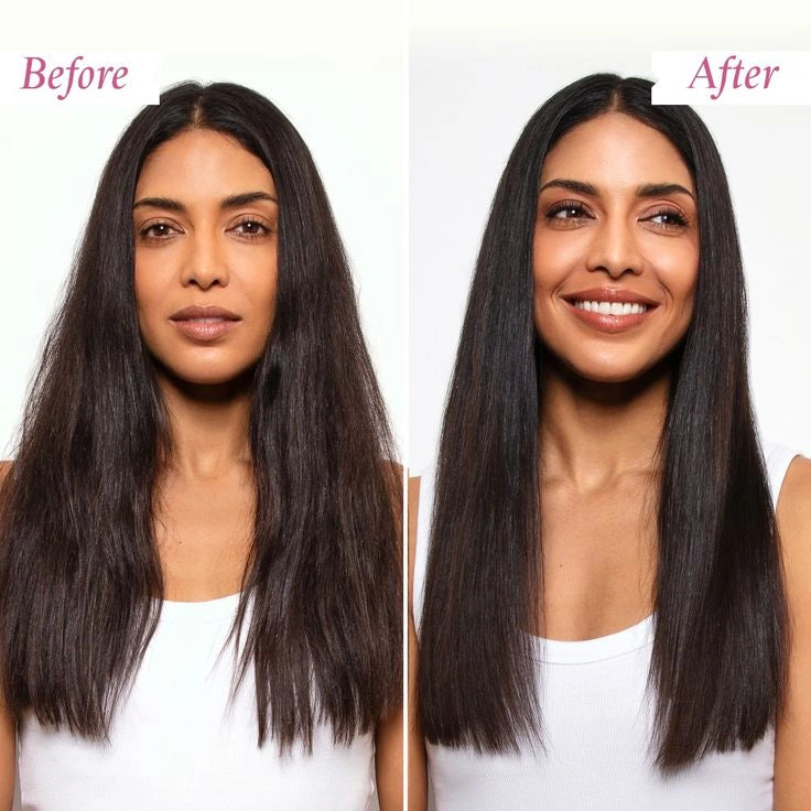 Before and After