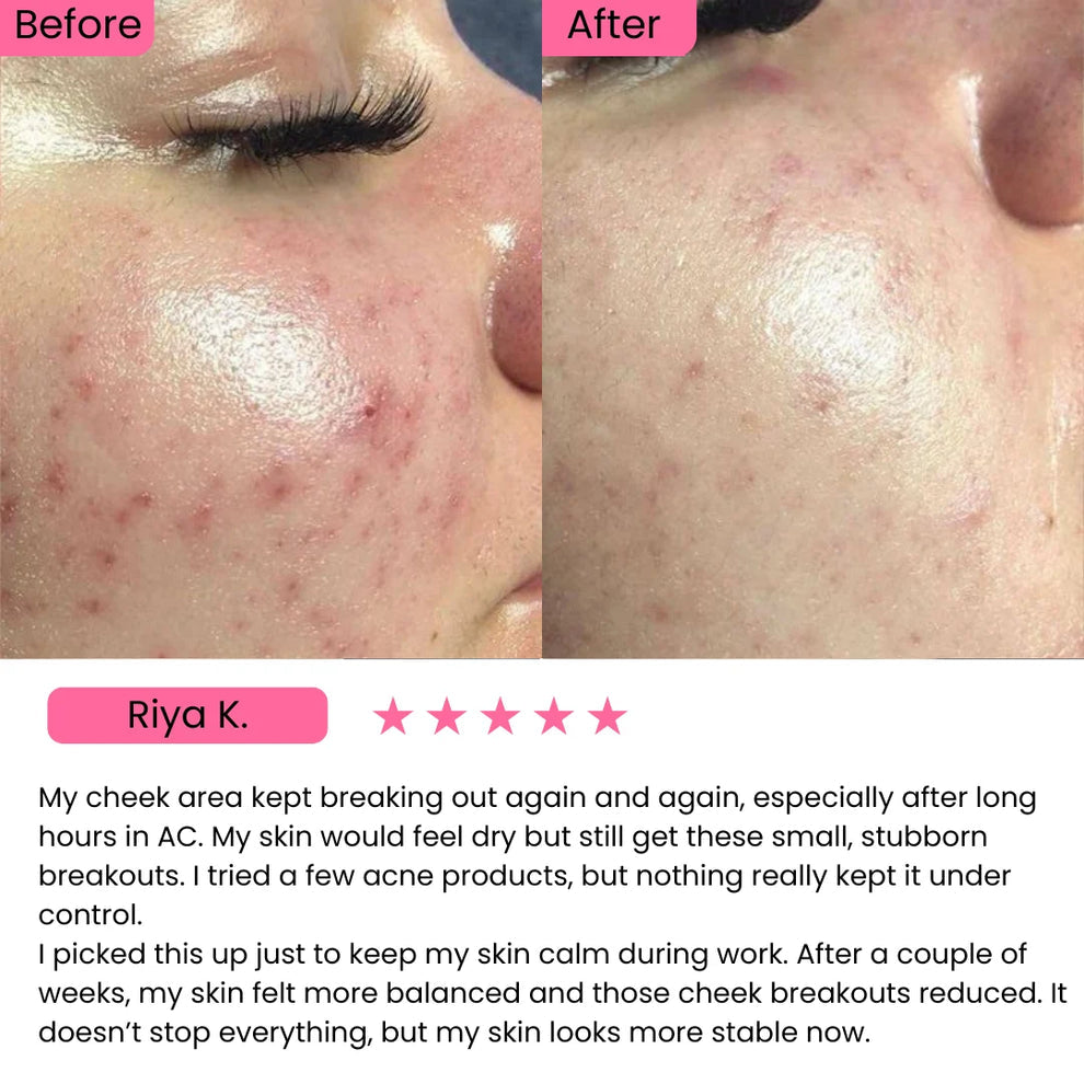 AXIS-Y Dark Spot Correcting Glow Serum (50ml)
