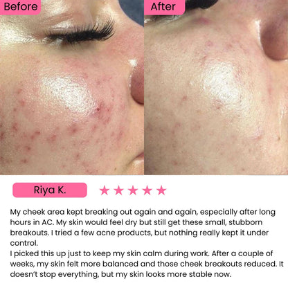 AXIS-Y Dark Spot Correcting Glow Serum (50ml)