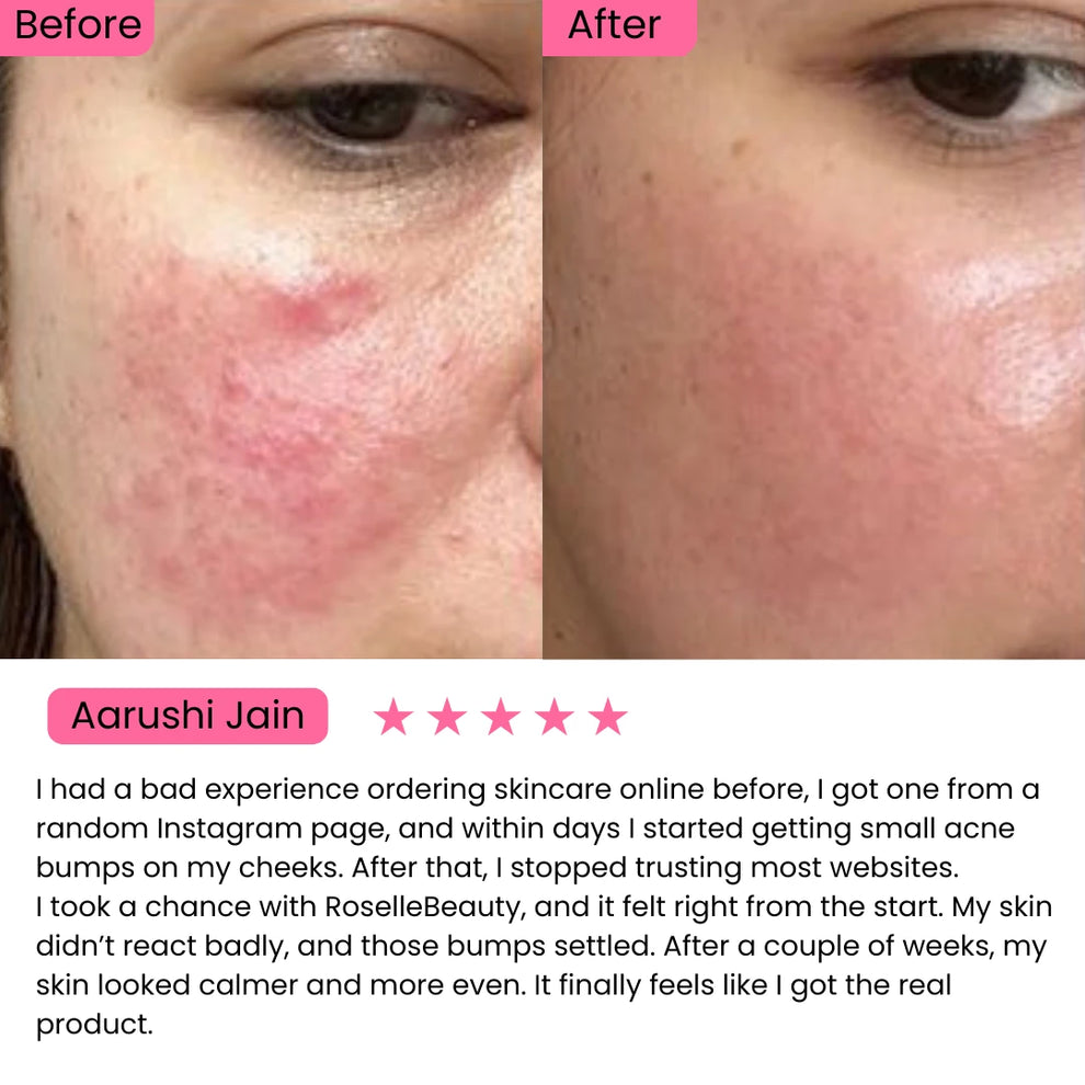 AXIS-Y Dark Spot Correcting Glow Serum (50ml)