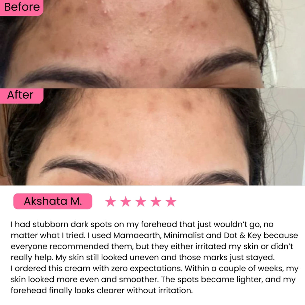 AXIS-Y Dark Spot Correcting Glow Serum (50ml)