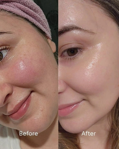 Repair Your Skin Barrier. Restore Your Glow.